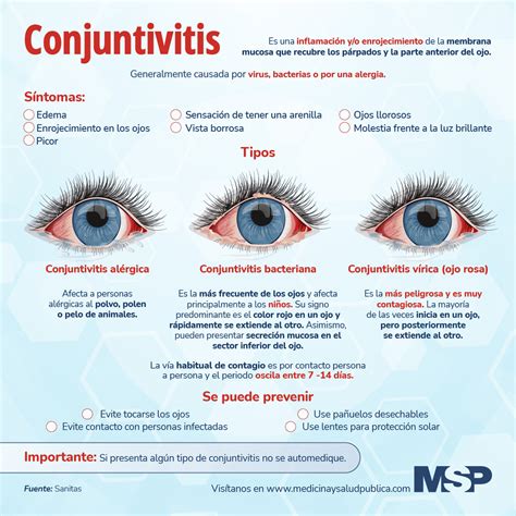 Diferencia Entre La Conjuntivitis Viral Y Bacteriana