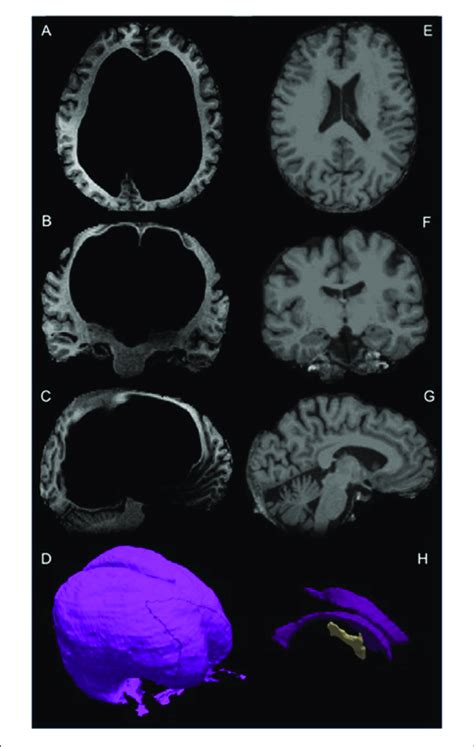 From Top To Bottom T1 Weighted Magnetic Resonance Imaging Mri