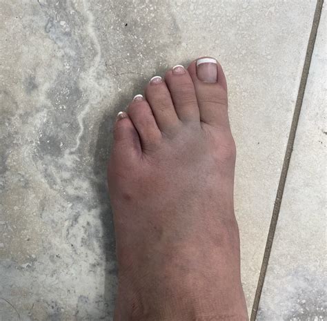 Tw Pornstars Karma Rx Twitter Lmfaooooo Update On The Foot