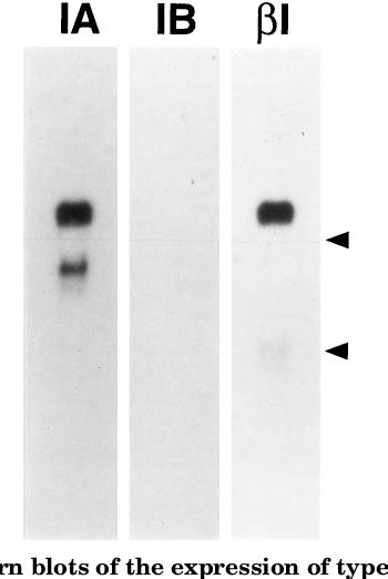 Figure From A Kinase Domain Truncated Type I Receptor Blocks Bone