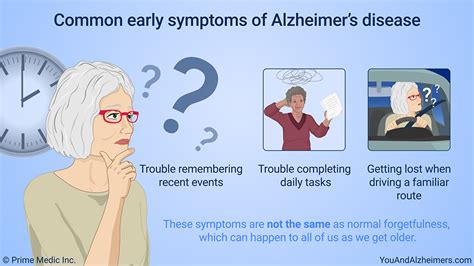 Slide Show Understanding Alzheimers Disease