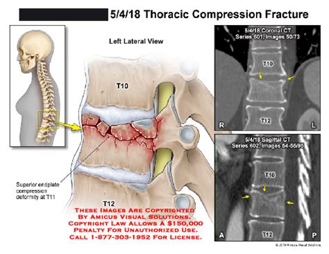 Medical Exhibits Demonstrative Aids Illustrations And Models