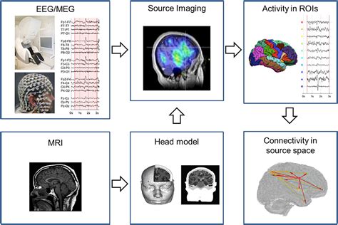 Frontiers Network Perspectives On Epilepsy Using EEG MEG Source