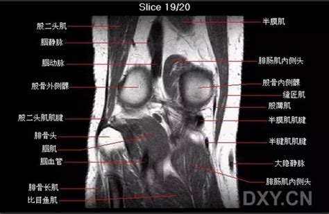 【关节影像】膝关节的磁共振（mri）解剖表现 好大夫在线