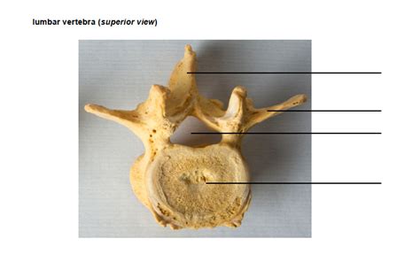 Diagram Lumbar Vertebra Superior View Diagram Quizlet