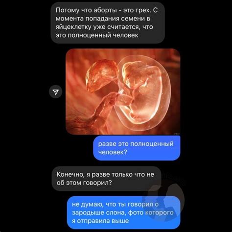 Аборты | Пикабу