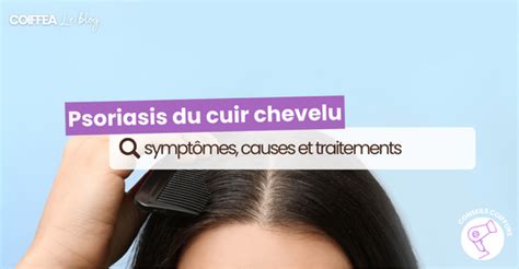 Comprendre Le Psoriasis Du Cuir Chevelu Sympt Mes Causes Et