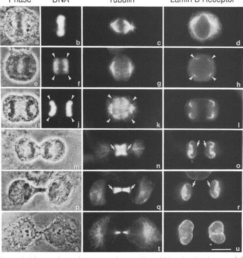 Figure 1 From Stepwise Reassembly Of The Nuclear Envelope At The End Of