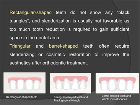 Interproximal Enamel Reduction Stripping Ppt