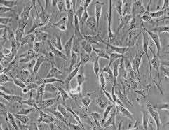 Human Skin Fibroblast, Human Dermal Fibroblast | Kosheeka