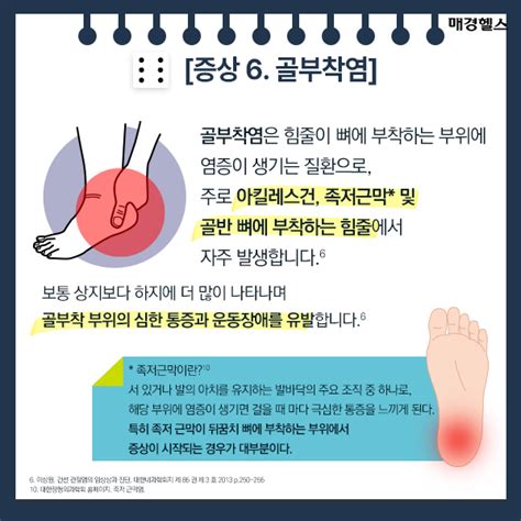 피부와 관절에 동시 증상이 건선성 관절염 의심