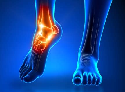 Chronic Ankle Pain Treatment Insync Health Clinic