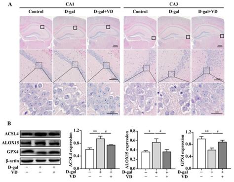 Ijms Special Issue New Insights Into Ferroptosis Inhibitors