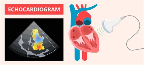 Cardiac Function Assessment In Echocardiographic Scans Biomedia