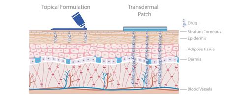 Topical And Transdermal Drug Products Making The Difference Through