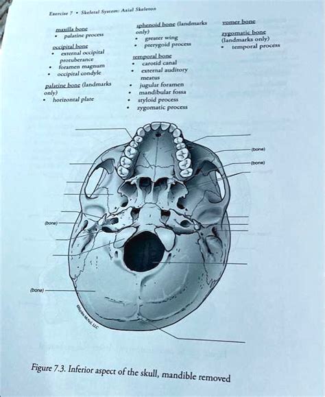 Solved Exercise 7 Skeletal System Axial Skeleton Bone Maxilla Bone