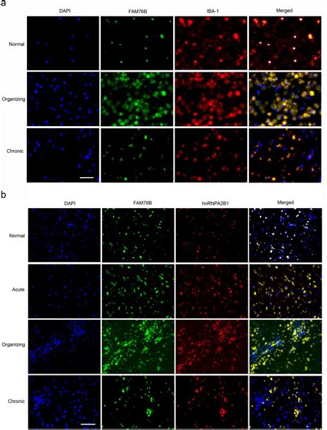 Fam76b Regulates Nf κb Mediated Inflammatory Pathway By Influencing The