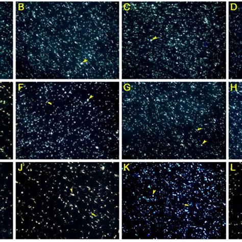 Photomicrographs Of Surviving Retinal Ganglion Cells Rgcs