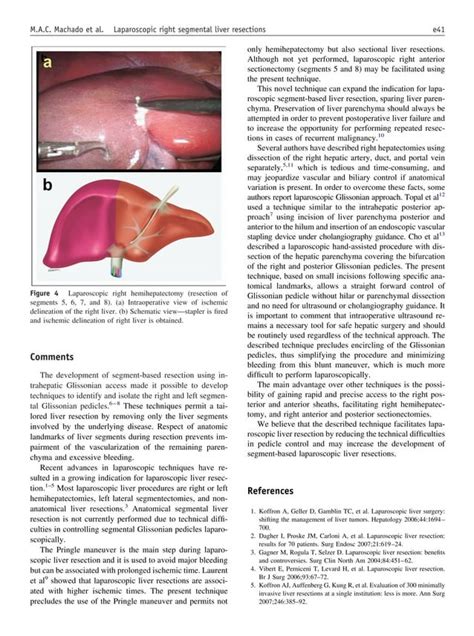 Glissonian Approach For Laparoscopic Liver Resections Pdf