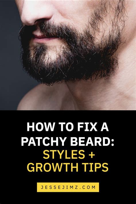 How To Fix A Patchy Beard Styles Growth Tips Patchy Beard Patchy Beard Styles Beard