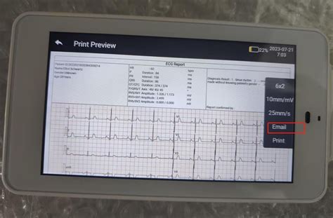 Mobile 6/12-Lead EKG/ECG Machine Fits into Your Pocket, with Auto Interpretation, Wirelessly ...