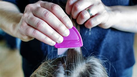 How To Treat Dog Lice Naturally