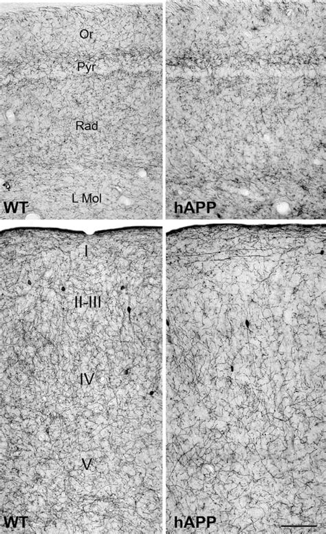 Low Power Photomicrographs Illustrating The Decrease In Density Of Ach