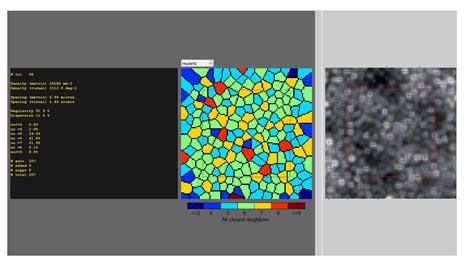 Adaptive Optics Treatment Management Point Of Care