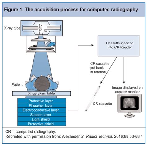 Radiology Film Screen Cassette