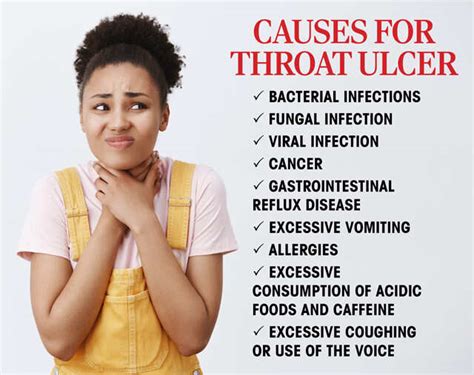 Mouth Ulcers And Sore Throat Causes - Infoupdate.org