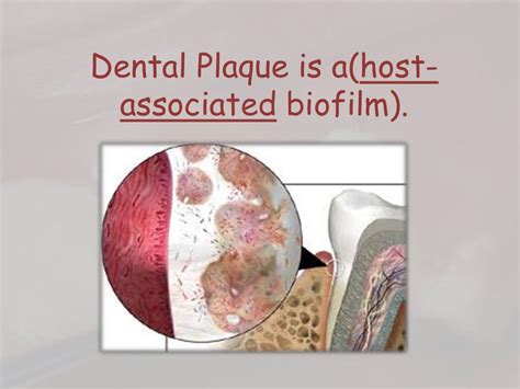 Dental plaque formation