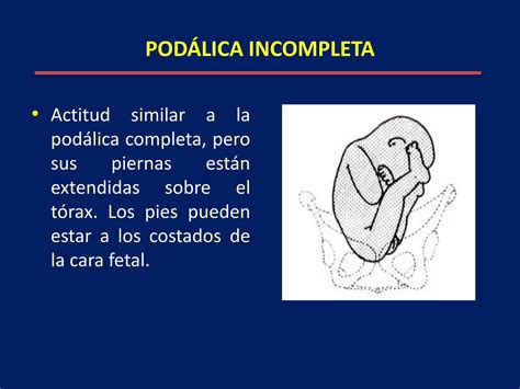 Clase Distocias De Presentaci N Pdf Descarga Gratuita