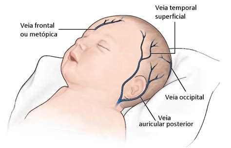 Enfermagem Amor Pun O Venosa E Administra O De Medica O Ev