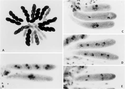 Figure 2 From Programmed Ascospore Death In The Homothallic Semantic