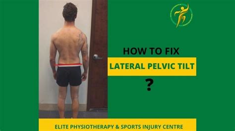 How To Fix Lateral Pelvic Tilt