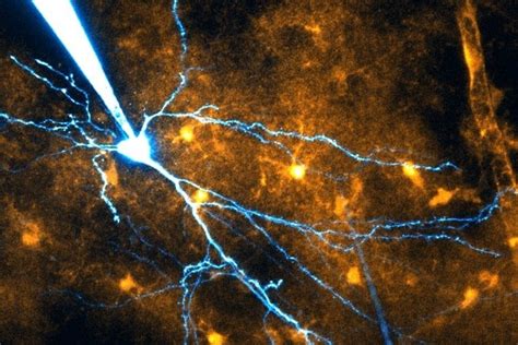 Glial Cells Help Memory Along - Neuroscience News