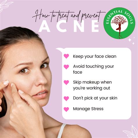 7 Effective Strategies To Treat And Prevent Acne Gala Of London