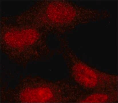 Monoclonal Anti Cda Antibody Produced In Mouse Clone Cda Purified