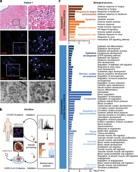 Quantitative Proteome Profiling Of Protein Signatures In COVID19 Skin