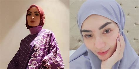 Sembuh Dari Kanker Potret Terbaru Imel Putri Cahyati Yang Kini Makin