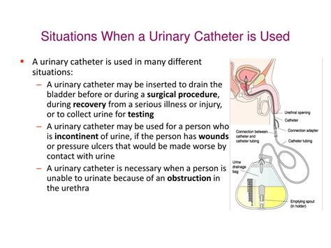 Ppt Urinary Catheter Powerpoint Presentation Free The Best Porn Website