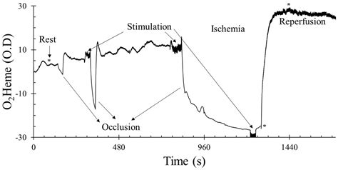 Interpretation Of Near Infrared Spectroscopy Nirs Signals In Skeletal