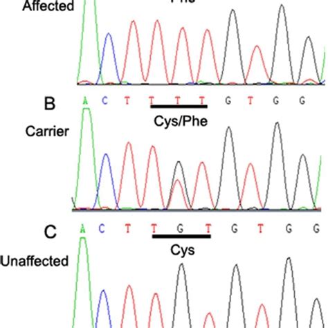 Dna Sequence Chromatograms Dna Sequence Chromatograms Of The Affected