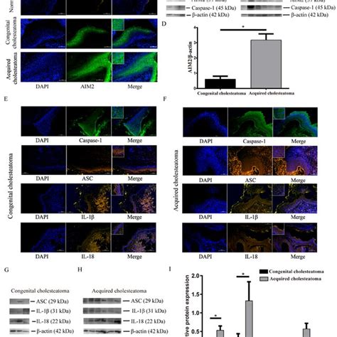 Immunofluorescence And Western Blotting Analyses Of Inflammasome