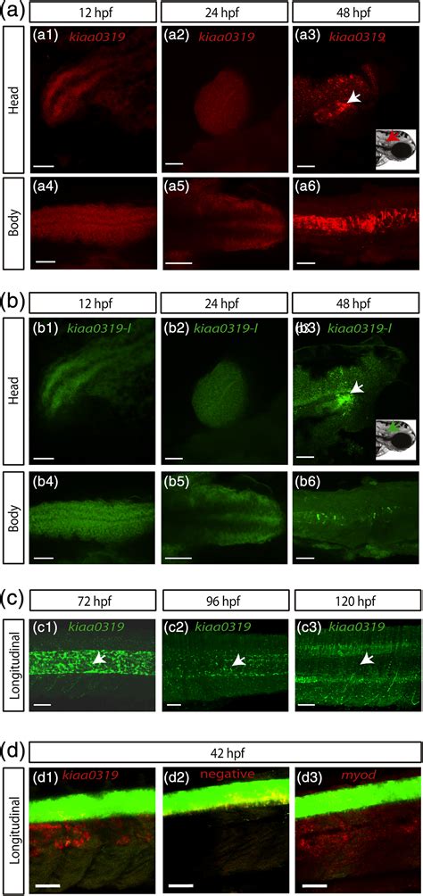 The Dyslexia Susceptibility Kiaa Gene Shows A Specific Expression