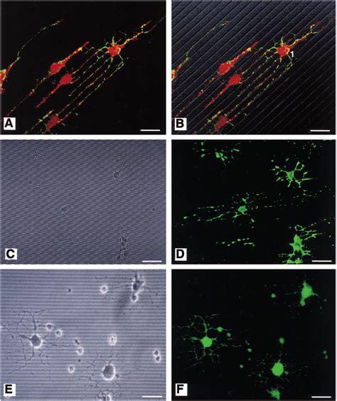 Confocal And Conventional Fluorescence Photomicrographs Of Cell