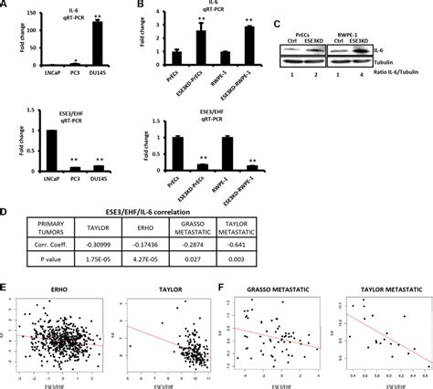 Ese Ehf And Il Expression Are Inversely Correlated A Il Top