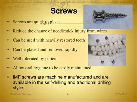 Mandibular Fractures