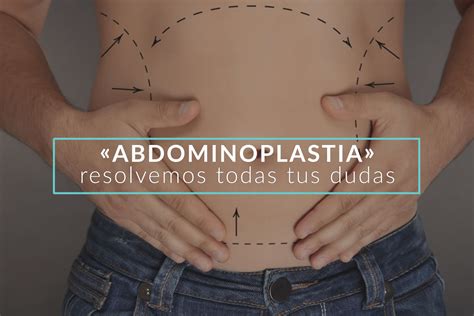 Abdominoplastia Qu Es Y C Mo Se Realiza Iconica Servicios M Dicos