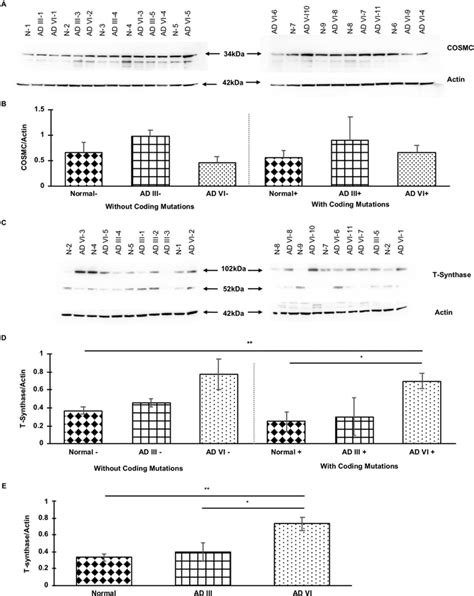 Western Blot And Imagej Analysis In Normal Ad Iii And Ad Vi Brain Download Scientific Diagram